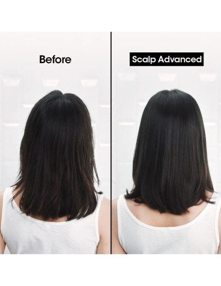 Scalp Advanced "Argile 2en1 Purifiante Anti-Gras" 250ML