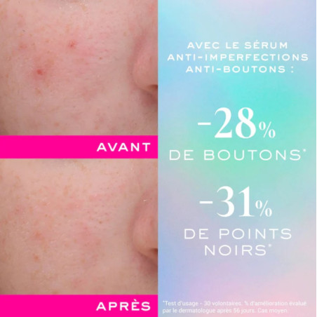 Zinc Power "Sérum Anti-Imperfections Anti-Boutons" 30ml